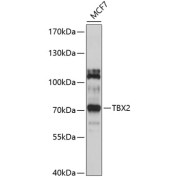 Western blot analysis of extracts of MCF-7 cells using TBX2 Antibody (1/1000 dilution).