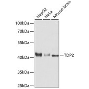Western blot analysis of extracts of various cell lines using TDP2 Antibody (1/3000 dilution).