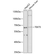 Western blot analysis of extracts of various cell lines using TEKT5 Antibody (1/3000 dilution).