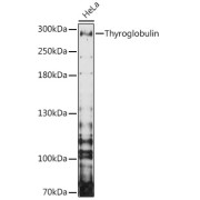 Western blot analysis of extracts of HeLa cells using Thyroglobulin Antibody (1/3000 dilution).