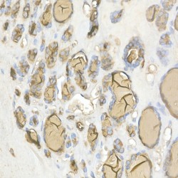 Thyroglobulin (TG) Antibody