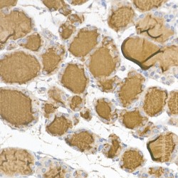 Thyroglobulin (TG) Antibody