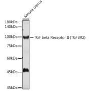 Western blot analysis of extracts of Mouse uterus using TGF beta Receptor II (TGF beta Receptor II (TGFBR2)) Antibody (1/1000 dilution).