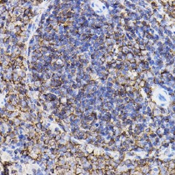 Transforming Growth Factor Beta Receptor 2 (TGFBR2) Antibody