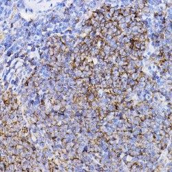 Transforming Growth Factor Beta Receptor 2 (TGFBR2) Antibody