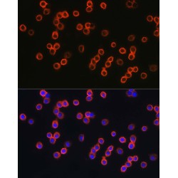 Toll Like Receptor 4 (TLR4) Antibody