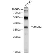 Western blot analysis of extracts of DU145 cells using TMEM74 Antibody (1/1000 dilution).