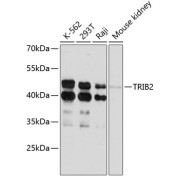 Western blot analysis of extracts of various cell lines using TRIB2 Antibody (1/3000 dilution).