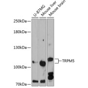 Western blot analysis of extracts of various cell lines using TRPM5 Antibody (1/3000 dilution).