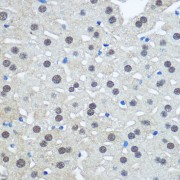Immunohistochemistry of paraffin-embedded Rat liver using UBA1 Antibody (1/100 dilution, 40x lens).
