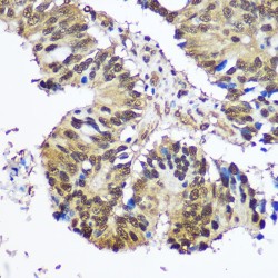 Ubiquitin Like Modifier Activating Enzyme 1 (UBA1) Antibody
