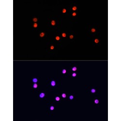 Ubiquitin Like Modifier Activating Enzyme 1 (UBA1) Antibody