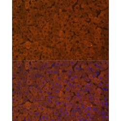 UDP-Glucuronosyltransferase 1-1 (UGT1A1) Antibody