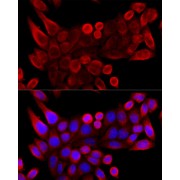 Immunofluorescence analysis of HeLa cells using VDAC3 Antibody (1/100 dilution, 40x lens). Blue: DAPI for nuclear staining.