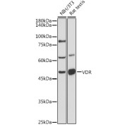 Western blot analysis of extracts of various cell lines using VDR Antibody (1/500 dilution).