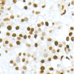 Vitamin D3 Receptor (VDR) Antibody