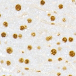 Vitamin D3 Receptor (VDR) Antibody