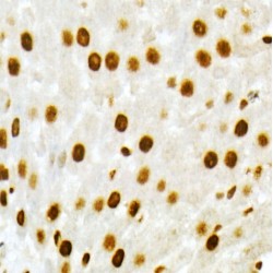 Vitamin D3 Receptor (VDR) Antibody