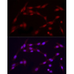 Vitamin D3 Receptor (VDR) Antibody