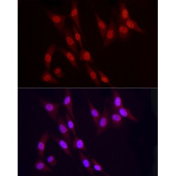 Vitamin D3 Receptor (VDR) Antibody