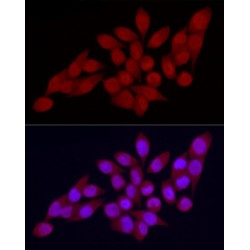 Vitamin D3 Receptor (VDR) Antibody