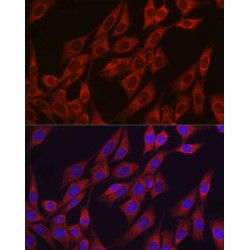 Vascular Endothelial Growth Factor A (VEGFA) Antibody