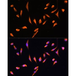 Vimentin (VIM) Antibody