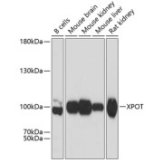 Western blot analysis of extracts of various cell lines using XPOT Antibody (1/3000 dilution).