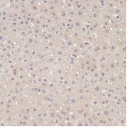 Immunohistochemistry of paraffin-embedded Rat liver using YAP1 Antibody (1/100 dilution, 40x lens).