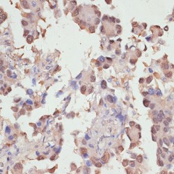 Yes-Associated Protein 1 (YAP1) Antibody