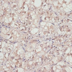 Yes-Associated Protein 1 (YAP1) Antibody