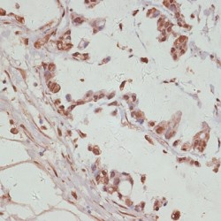 Yes-Associated Protein 1 (YAP1) Antibody