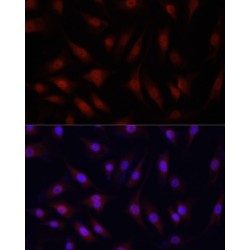 Yes-Associated Protein 1 (YAP1) Antibody