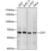 Western blot analysis of extracts of various cell lines using CSF1 Antibody (1/1000 dilution).