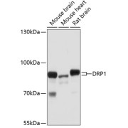 Western blot analysis of extracts of various cell lines using DRP1 Antibody (1/1000 dilution).