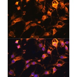 Dynamin 1 Like Protein (DNM1L) Antibody