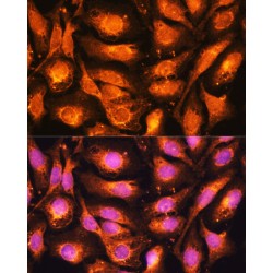 Dynamin 1 Like Protein (DNM1L) Antibody