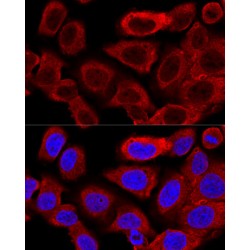 Dynamin 1 Like Protein (DNM1L) Antibody