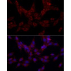 Signal Recognition Particle Subunit SRP72 (SRP72) Antibody