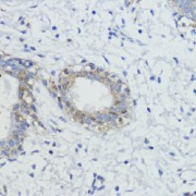 abx127099