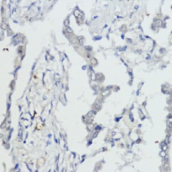 RAC-Alpha Serine/threonine-Protein Kinase (AKT1) Antibody