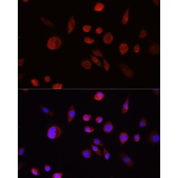 RAC-Alpha Serine/threonine-Protein Kinase (AKT1) Antibody