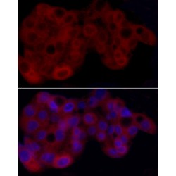 Heme Oxygenase 1 (HMOX1) Antibody