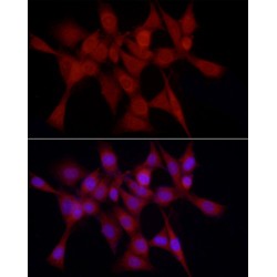 Heme Oxygenase 1 (HMOX1) Antibody