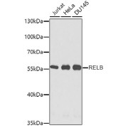 Western blot analysis of extracts of various cell lines using RELB Antibody (1/1000 dilution).