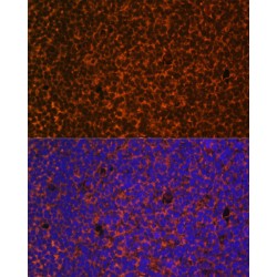 Protein Patched Homolog 1 (PTCH1) Antibody