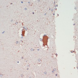 Leucine-Rich Repeat Serine/Threonine-Protein Kinase 2 (LRRK2) Antibody