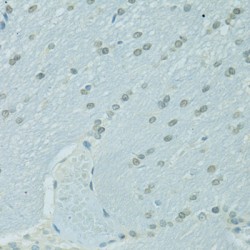CCAAT/Enhancer Binding Protein Alpha (CEBPA) Antibody