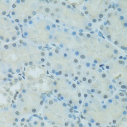 CCAAT/Enhancer Binding Protein Alpha (CEBPA) Antibody