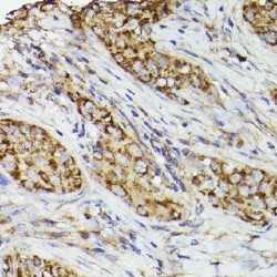 Prostaglandin G/H Synthase 2 / COX-2 (PTGS2) Antibody